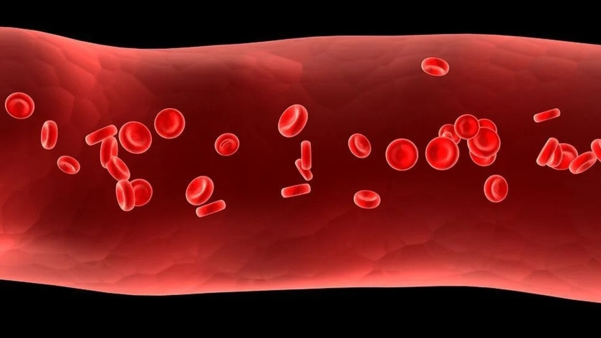 Θρομβοπενία: Αίτια, Συμπτώματα &amp; Θεραπεία